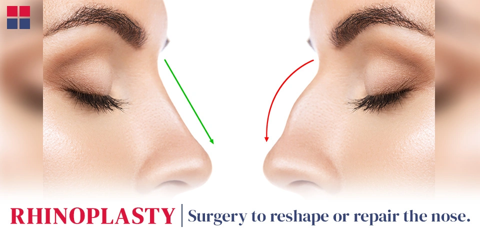 What is Rhinoplasty?