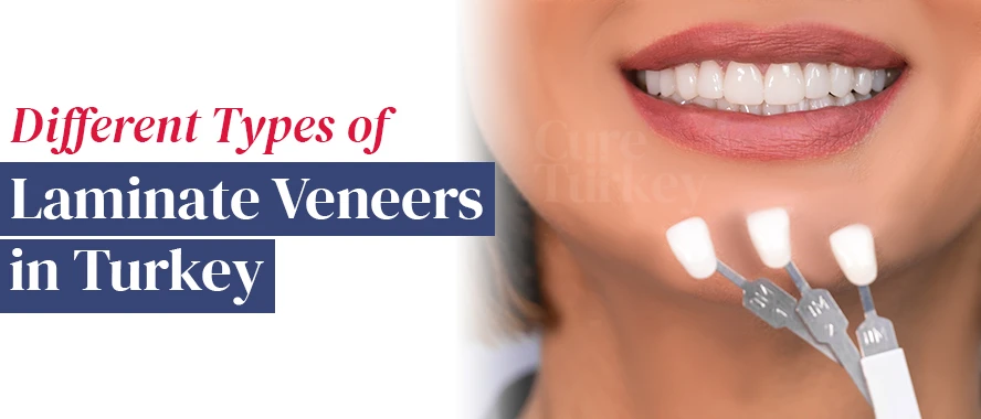 How much veneers in Turkey
