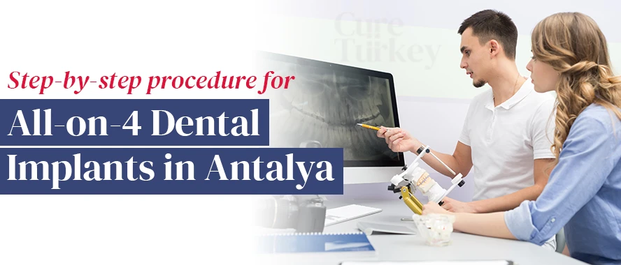All-on-4 dental implants in Antalya procedure