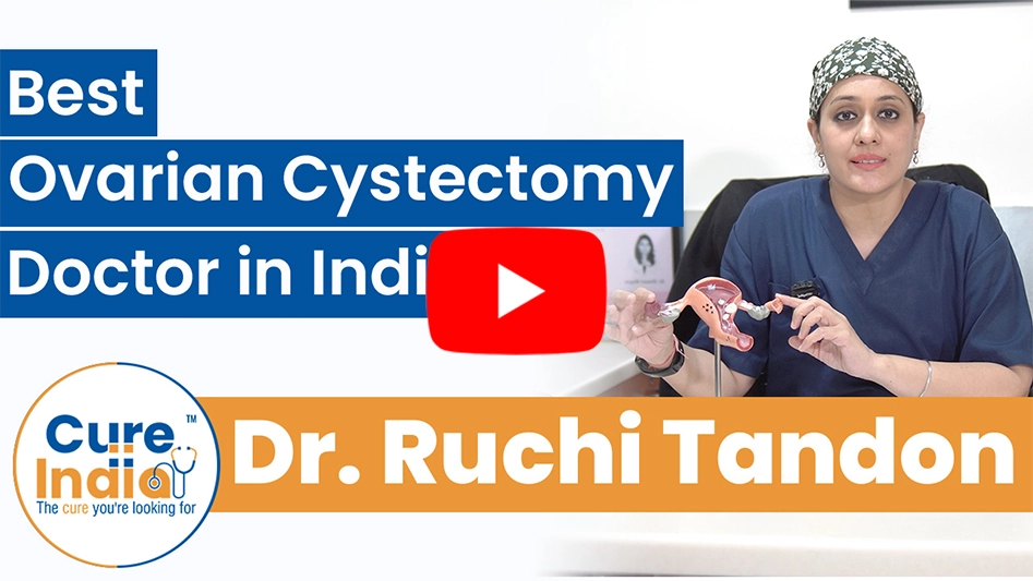 Dr. Ruchi Tandon - Ovarian Cyst Treatment in India