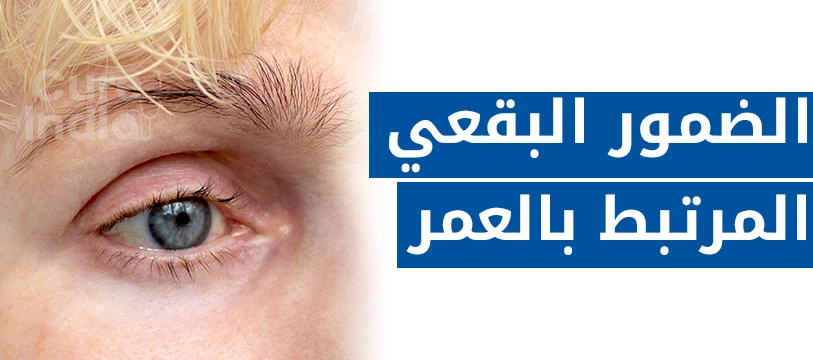 علاج التنكس البقعي في العين في الهند