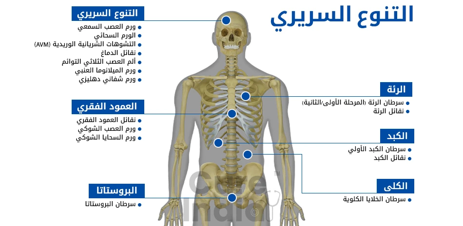 الحالات التي يمكن علاجها عن طريق جراحة الراديو عبر سايبر نايف