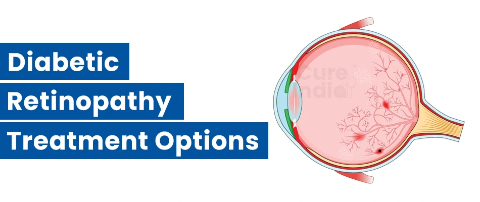 Diabetic Retinopathy Treatment Options