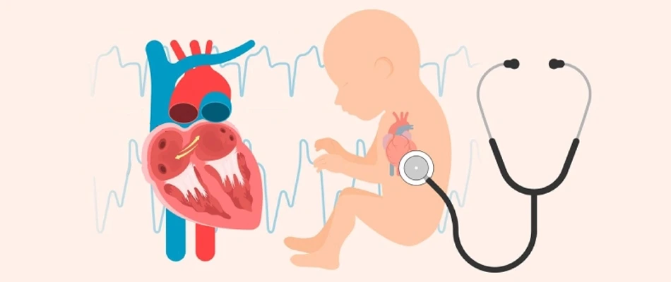 Symproms of Congenital Heart Defect in Infants