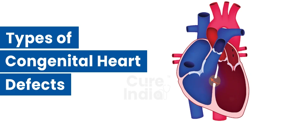 Types of Congenital Heart Defects