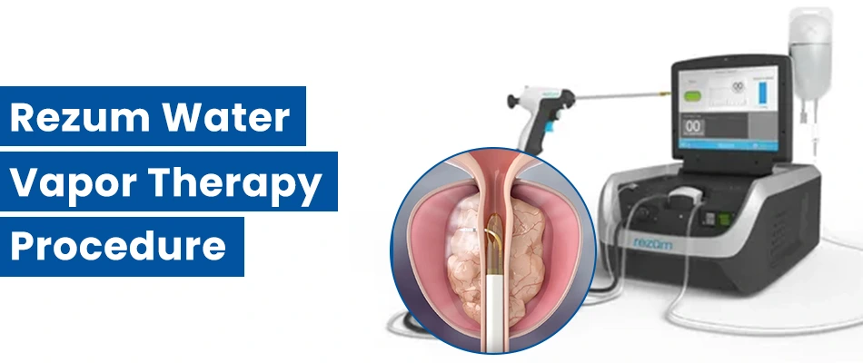 What is the Rezum Water Vapor Therapy Procedure in India