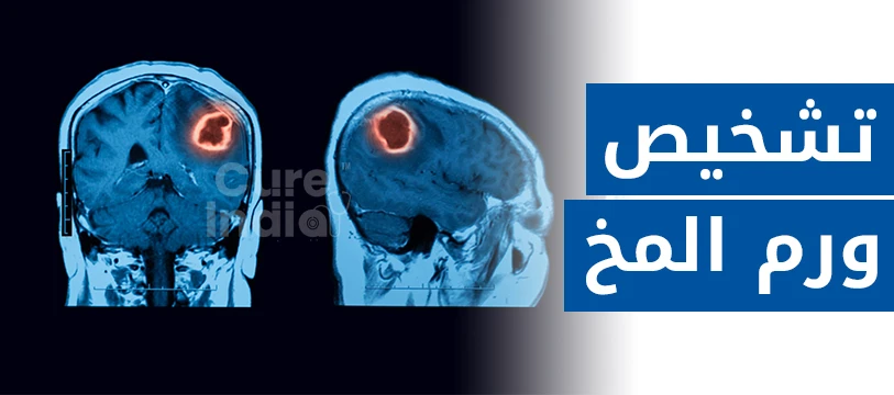 تشخيص ورم المخ
