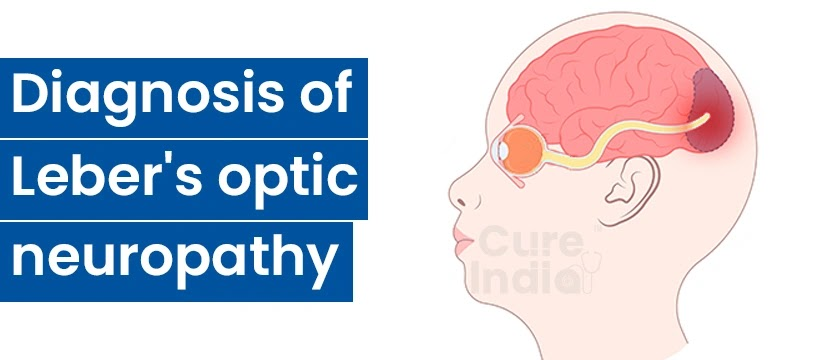 Diagnosis of Leber's Optic Neuropathy