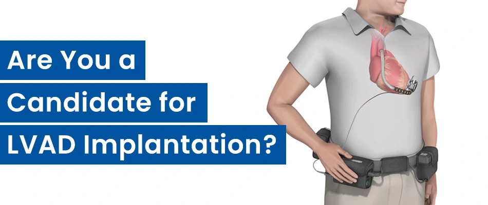 Are You a Candidate for Artificial Heart?