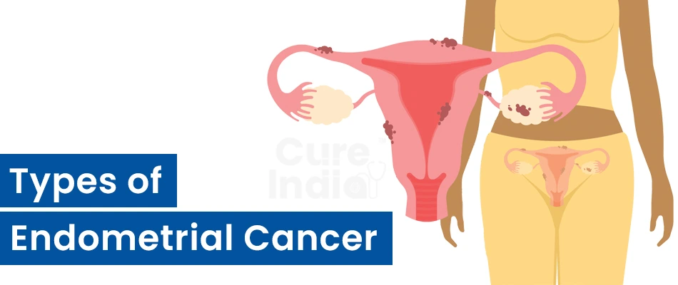 Types of Endometrial Cancer