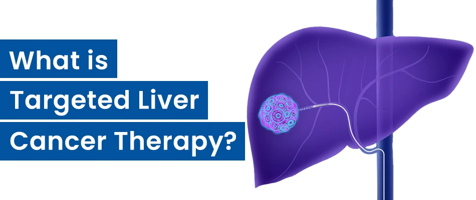 What is Targeted Liver CancerTherapy