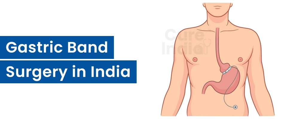 Gastric Band Surgery Procedure in India