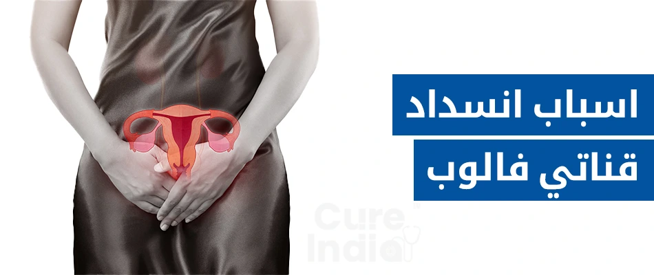 اسباب انسداد قناتي فالوب