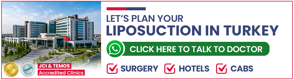 Plan Your Liposuction Surgery in Turkey