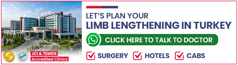 Plan Your Limb lengthening in Turkey