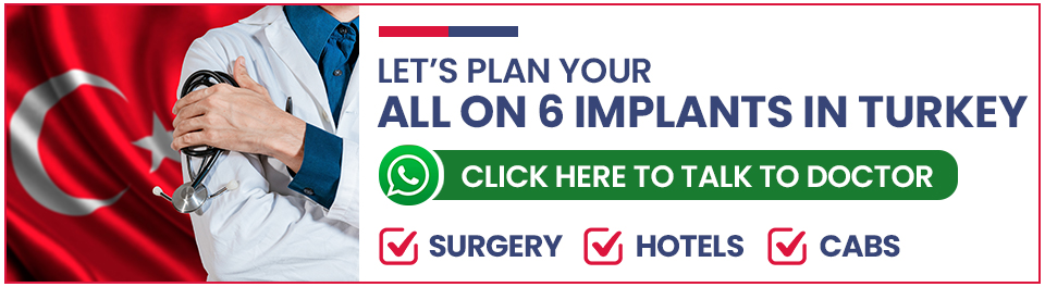Plan Your All on 6 Dental Implants in Turkey
