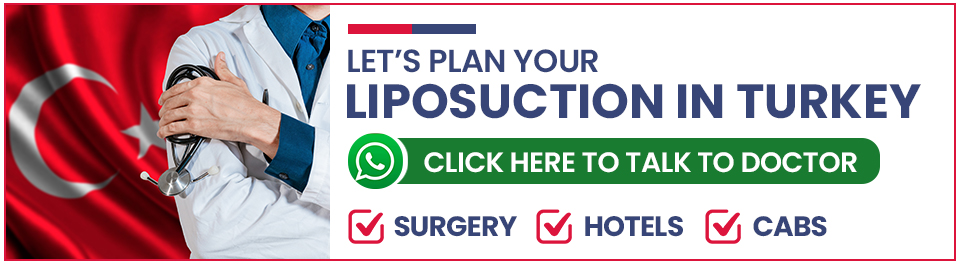 Plan Your Liposuction Surgery in Turkey