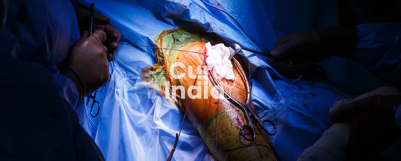 Orthopedic Implant Removal - Sama Hospital - A NABH Accredited