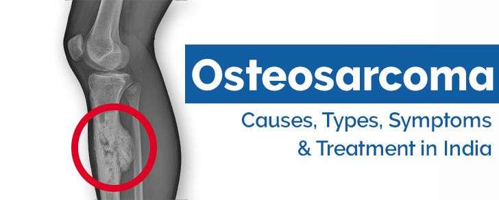 Osteosarcoma or Soft Tissue Sarcoma