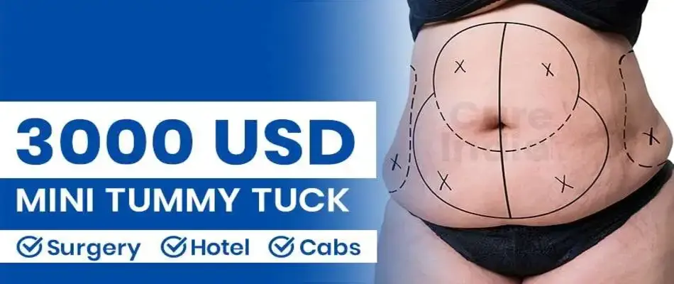Mini Tummy Tuck Cost $3,000