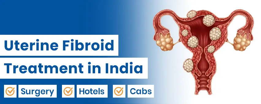 Uterine Fibroid Treatment