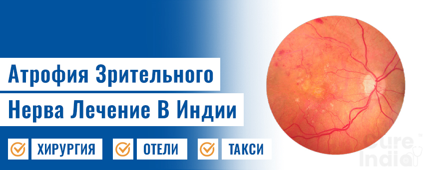 Атрофия Зрительного Нерва
