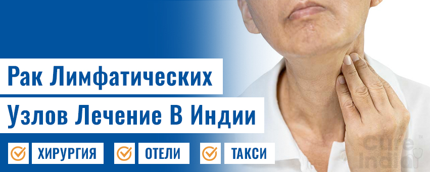 Рак Лимфатических Узлов
