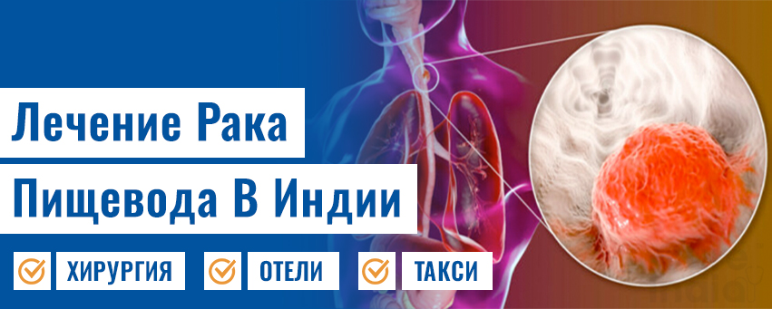 Лечение Рака Пищевода