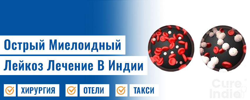 Острый Миелоидный Лейкоз