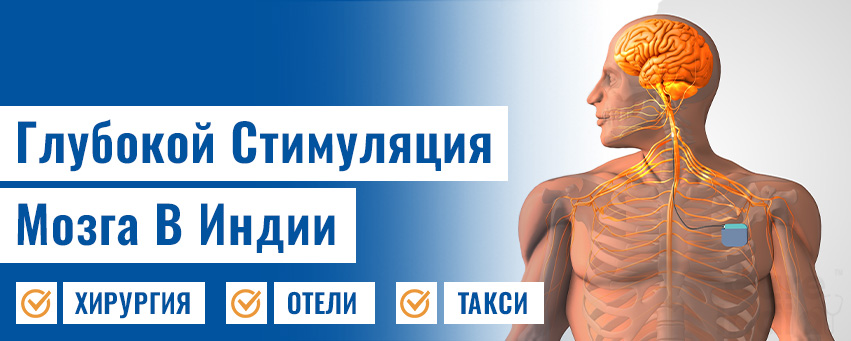 Глубокой Стимуляция Мозга