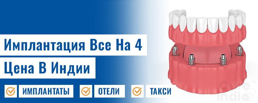 Имплантация Все На 4 Цена