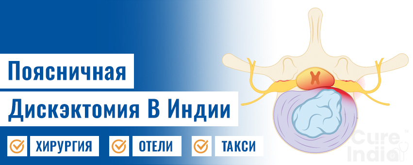 Поясничная Дискэктомия