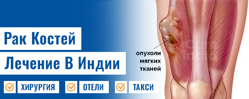 Ортопедическая онкология / опухоли костей и тканей