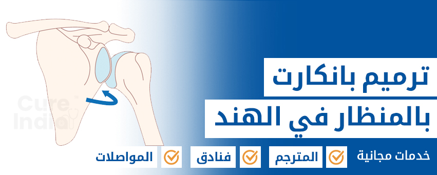 إصلاح بانكارت وصفعة المسيل للدموع بالمنظار