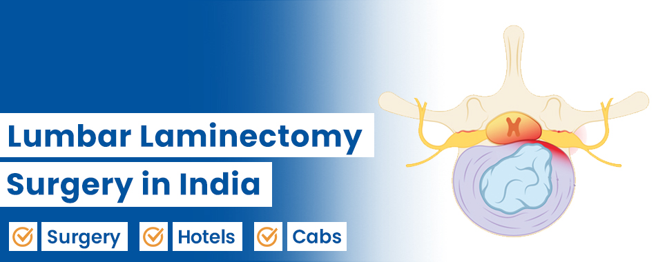 Lumbar Laminectomy
