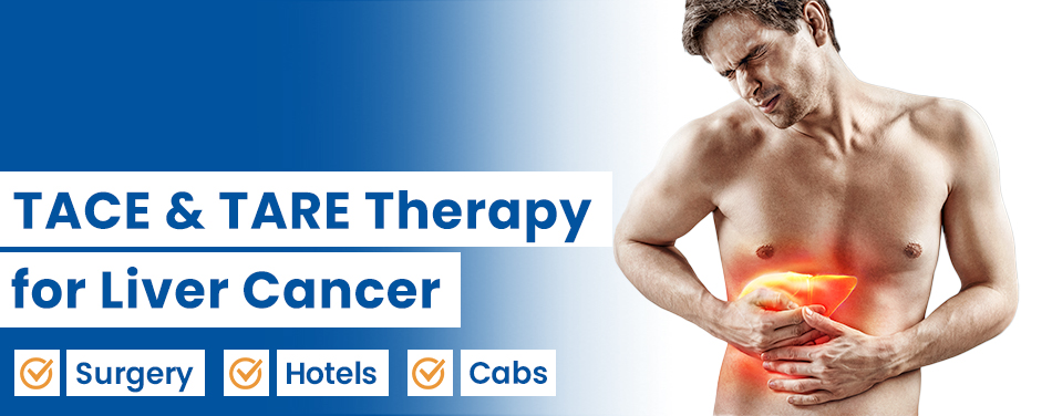 TACE & TARE Therapy for Liver Cancer Treatment