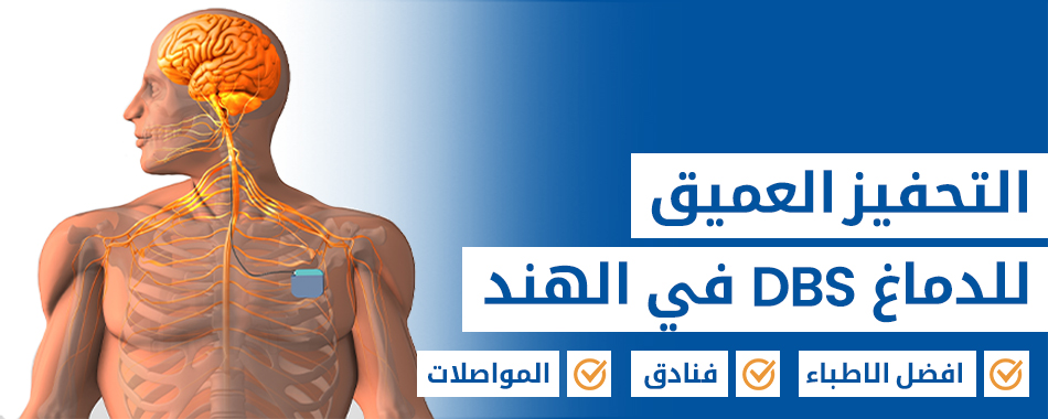 التحفيز العميق للدماغ