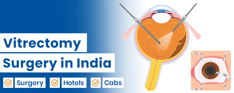 Vitrectomy Surgery