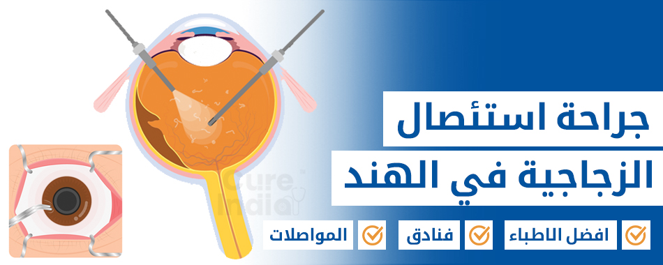 جراحة استئصال الزجاجية