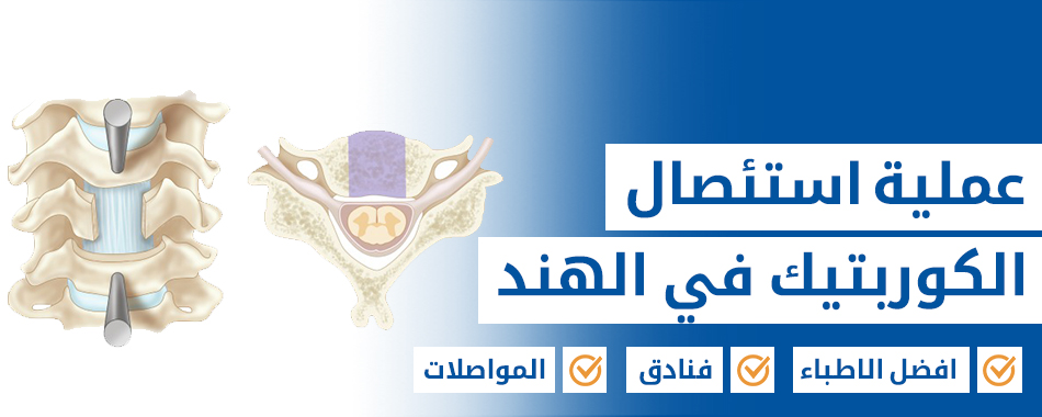 عملية استئصال الكوربتيك