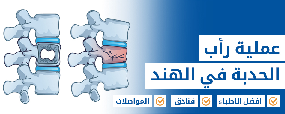 عملية  رأب الحدبة