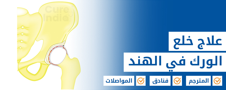 خلل التنسيج الوركي