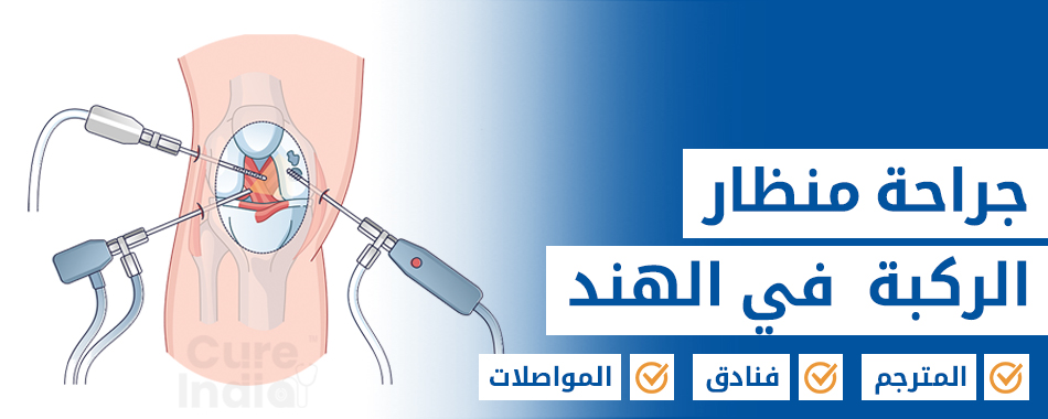 تنظير الركبة