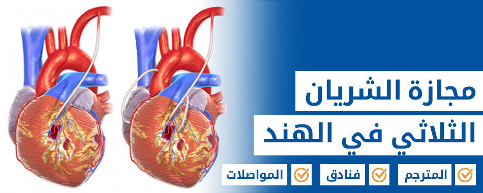 مجازة الشريان الثلاثي