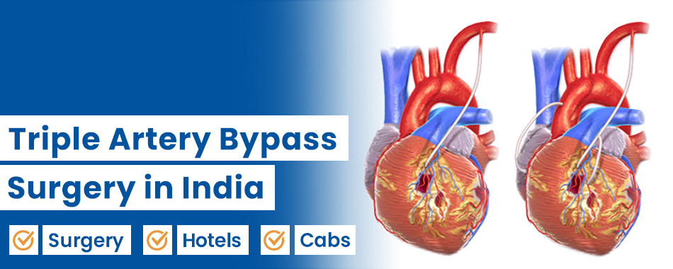 Triple Artery Bypass
