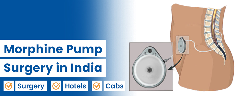 Morphine Pump Implant