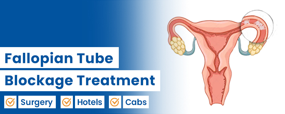 Blocked Fallopian Tubes
