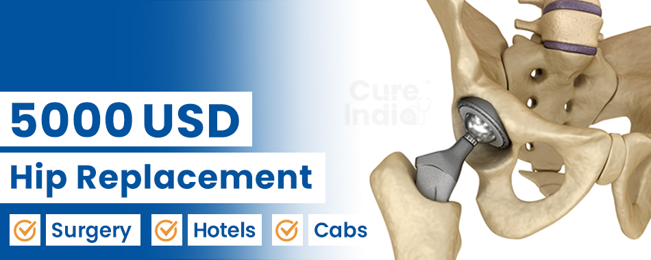 Hip Replacement Surgery Cost