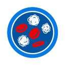 Острый Миелоидный Лейкоз