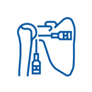 إصلاح بانكارت وصفعة المسيل للدموع بالمنظار